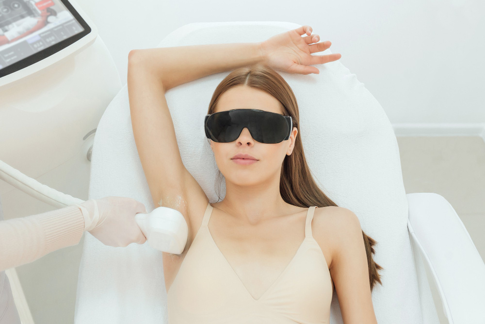 Clareamento axilas a laser em Marabá: Renove sua pele e sinta-se ainda mais confiante