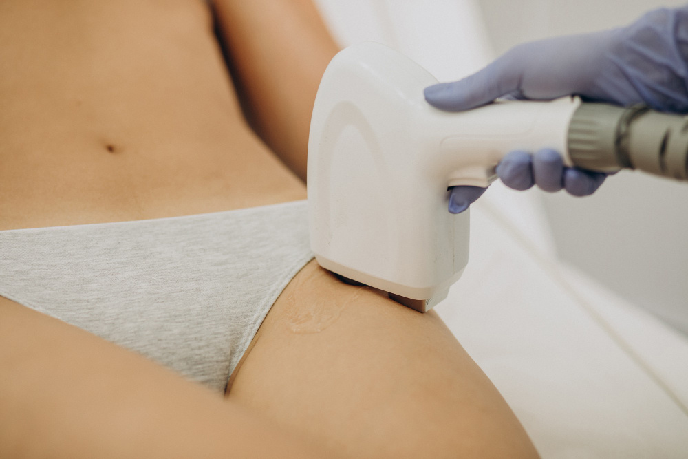 Clareamento íntimo a laser em Eldorado dos Carajás: Marque sua sessão exclusiva e sinta a diferença desde a primeira aplicação